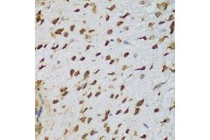 Immunohistochemistry of paraffin-embedded mouse brain using NCL antibody (ABIN5975400) at dilution of 1/200 (40x lens). (Nucleolin anticorps)