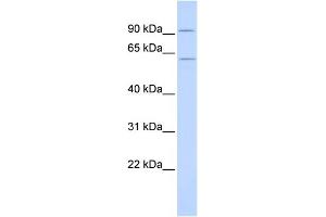 WB Suggested Anti-CUGBP2 Antibody Titration:  0. (CELF2 anticorps  (N-Term))