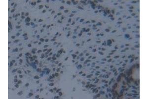 Detection of IRF2 in Mouse Uterus Tissue using Polyclonal Antibody to Interferon Regulatory Factor 2 (IRF2)