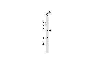 Anti-NR1I2 Antibody (Center) at 1:1000 dilution + Hela whole cell lysate Lysates/proteins at 20 μg per lane.