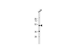 Anti-NR1I2 Antibody (Center) at 1:1000 dilution + Hela whole cell lysate Lysates/proteins at 20 μg per lane. (NR1I2 anticorps  (AA 100-127))