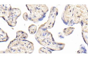 Detection of INSR in Human Placenta Tissue using Polyclonal Antibody to Insulin Receptor (INSR)