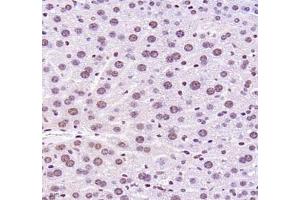 Immunohistochemistry of paraffin embedded mouse liver using MECOM (ABIN7074575) at dilution of 1: 2200 (400x lens)
