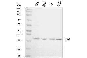 Western blot analysis of UCP3 using anti-UCP3 antibody (ABIN7603247).