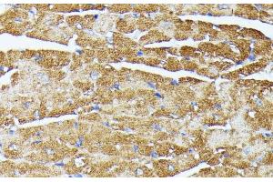 Immunohistochemistry of paraffin-embedded Mouse heart using TRAP1 Polyclonal Antibody at dilution of 1:100 (40x lens). (TRAP1 anticorps)