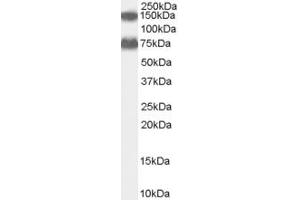 Western Blotting (WB) image for anti-Dehydrogenase/reductase (SDR Family) Member 4 (DHRS4) (Middle Region) antibody (ABIN2156699) (DHRS4 anticorps  (Middle Region))