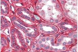 Kidney: Formalin-Fixed Paraffin-Embedded (FFPE) (Collagen IV anticorps)