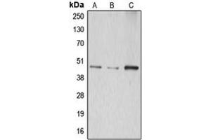 Western blot analysis of ABHD8 expression in HepG2 (A), mouse kidney (B), rat kidney (C) whole cell lysates.