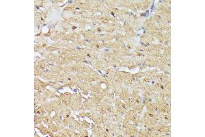 Immunohistochemistry of paraffin-embedded rat heart using TRIP4 antibody (ABIN7270824) at dilution of 1:100 (40x lens). (TRIP4 anticorps  (AA 282-581))