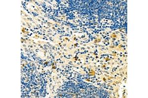 Immunohistochemistry of paraffin embedded mouse lymph node using BIRC3 (ABIN7073179) at dilution of 1: 1800 (400x lens)