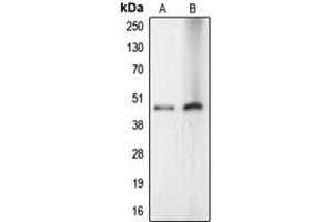 Western blot analysis of LASS4 expression in HeLa (A), Jurkat (B) whole cell lysates. (LASS4 anticorps  (Center))