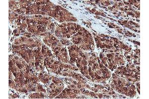 Image no. 12 for anti-Proteasome (Prosome, Macropain) Subunit, beta Type, 7 (PSMB7) (AA 58-277) antibody (ABIN1491598)