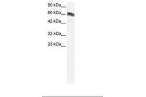 Image no. 1 for anti-Forkhead Box C2 (MFH-1, Mesenchyme Forkhead 1) (FOXC2) (AA 212-261) antibody (ABIN202667) (FOXC2 anticorps  (AA 212-261))