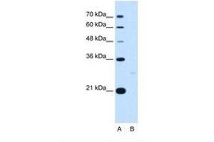 Image no. 1 for anti-14-3-3 zeta (YWHAZ) (C-Term) antibody (ABIN321366) (14-3-3 zeta anticorps  (C-Term))