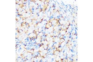 Immunohistochemistry of paraffin-embedded rat ovary using Filamin A Rabbit mAb (ABIN1682545, ABIN3018024, ABIN3018025 and ABIN7101570) at dilution of 1:100 (40x lens). (Filamin A anticorps)