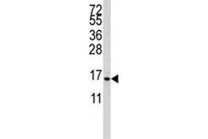 Western blot analysis of S100A11 antibody and CEM lysate.