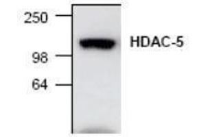 Image no. 1 for anti-Histone Deacetylase 5 (HDAC5) antibody (ABIN127240) (HDAC5 anticorps)