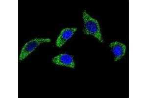 Confocal immunofluorescent analysis of TNFR antibody with U-251MG cells followed by Alexa Fluor 488-conjugated goat anti-rabbit lgG (green).