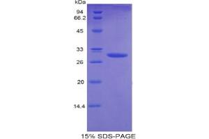 SDS-PAGE analysis of Mouse Plastin 3 Protein.