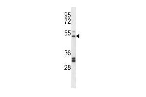 Western blot analysis in K562 cell line lysates (35ug/lane).