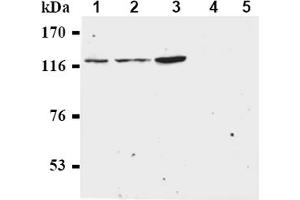 Western Blotting (WB) image for anti-Budding Uninhibited By Benzimidazoles 1 Homolog beta (Yeast) (BUB1B) antibody (ABIN567606) (BUB1B anticorps)