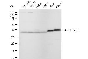 Western blotting analysis using Emerin antibody (ABIN7798436). (Recombinant Emerin anticorps)
