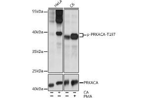 Western blot analysis of extracts of various cell lines, using Phospho-PKA C-alpha (PRKACA)-T197 pAb (ABIN6135290, ABIN6136202, ABIN6136203 and ABIN6225582) at 1:2000 dilution or PKA C-alpha (PRKACA) antibody (ABIN7269625). (PRKACA anticorps  (pThr197))