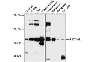 Western blot analysis of extracts of various cell lines, using GUCY1 antibody (ABIN6127969, ABIN6141533, ABIN6141534 and ABIN6216446) at 1:3000 dilution. (GUCY1A1 anticorps  (AA 1-120))