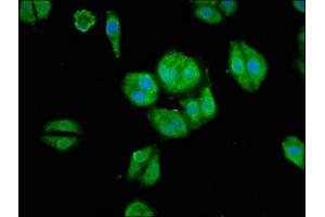 Immunofluorescence staining of HepG2 cells with ABIN7167935 at 1:66, counter-stained with DAPI. (ARHGAP18 anticorps  (AA 389-577))