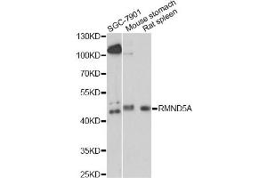 Western blot analysis of extracts of various cell lines, using RMND5A antibody.