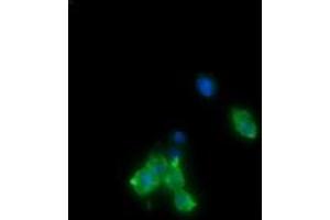 Image no. 2 for anti-Cancer/testis Antigen 1B (CTAG1B) antibody (ABIN1499898) (CTAG1B anticorps)