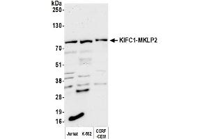 Western Blotting (WB) image for anti-Kinesin Family Member C1 (KIFC1) (AA 1-50) antibody (ABIN7453560) (KIFC1 anticorps  (AA 1-50))