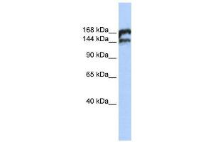 WB Suggested Anti-TOP2B  Antibody Titration: 0. (TOP2B anticorps  (Middle Region))