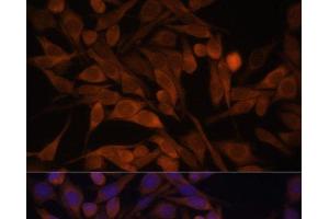 Immunofluorescence analysis of HeLa cells using CACYBP Polyclonal Antibody at dilution of 1:100.