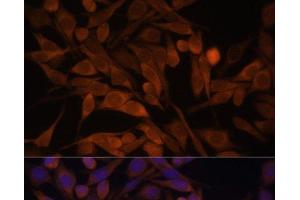 Immunofluorescence analysis of HeLa cells using CACYBP Polyclonal Antibody at dilution of 1:100. (CACYBP anticorps)