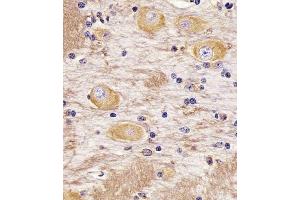 (ABIN388782 and ABIN2839114) staining TAU in Cynomolgus Monkey brain tissue sections by Immunohistochemistry (IHC-P - paraformaldehyde-fixed, paraffin-embedded sections). (tau anticorps  (C-Term))