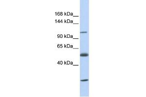 WB Suggested Anti-SLC39A10 Antibody Titration:  0. (SLC39A10 anticorps  (N-Term))