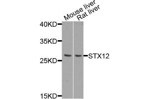 Western blot analysis of extract of mouse liver and rat liver cells, using STX12 antibody. (Syntaxin 12 anticorps)