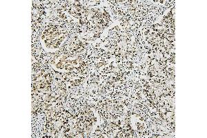 IHC analysis of NRF1 using anti-NRF1 antibody (ABIN7600874).