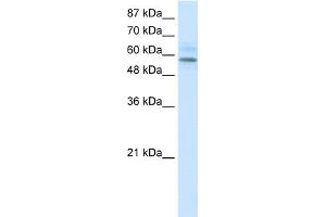 WB Suggested Anti-MGC4618 Antibody   Titration: 1. (TMEM175 anticorps  (N-Term))