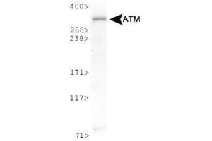 Image no. 3 for anti-Ataxia Telangiectasia Mutated (ATM) (C-Term) antibody (ABIN363380)
