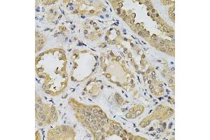 Immunohistochemistry of paraffin-embedded human kidney using N6AMT1 Antibody (ABIN5974334) at dilution of 1/100 (40x lens). (N6AMT1 anticorps)