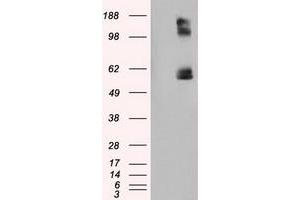 Image no. 6 for anti-Lipase, Endothelial (LIPG) antibody (ABIN1499176) (LIPG anticorps)