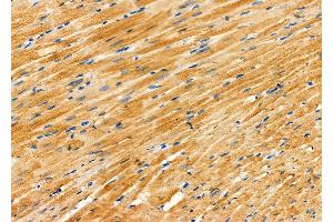 ABIN6264375 and ABIN6276958 at 1/100 staining Rat heart tissue by IHC-P.