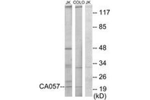 Western blot analysis of extracts from Jurkat/COLO205 cells, using C1orf57 Antibody. (C1orf57 anticorps  (AA 141-190))