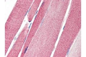 Human Skeletal Muscle (formalin-fixed, paraffin-embedded) stained with LGI4at 5 µg/ml followed by biotinylated goat anti-rabbit IgG secondary antibody, alkaline phosphatase-streptavidin and chromogen. (LGI4 anticorps)