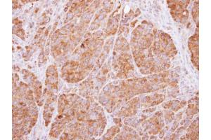 IHC-P Image Immunohistochemical analysis of paraffin-embedded SW480 xenograft, using 14-3-3 beta, antibody at 1:500 dilution.