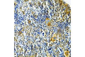 Immunohistochemistry of paraffin-embedded mouse spleen using GLRX Antibody (ABIN6127980, ABIN6141147, ABIN6141149 and ABIN6220940) at dilution of 1:200 (40x lens).