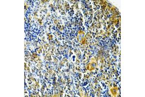 Immunohistochemistry of paraffin-embedded mouse spleen using GLRX Antibody (ABIN6127980, ABIN6141147, ABIN6141149 and ABIN6220940) at dilution of 1:200 (40x lens). (Glutaredoxin 1 anticorps  (AA 1-106))