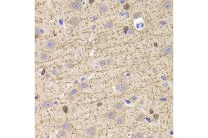 Immunohistochemistry of paraffin-embedded Rat brain using CNP antibody at dilution of 1:100 (x400 lens). (Cnpase anticorps)